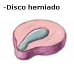 El dolor a la derecha bajo los bordes da detrás en la espalda